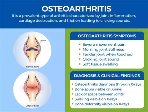 Osteoarthritis Vs Rheumatoid arthritis What you should know