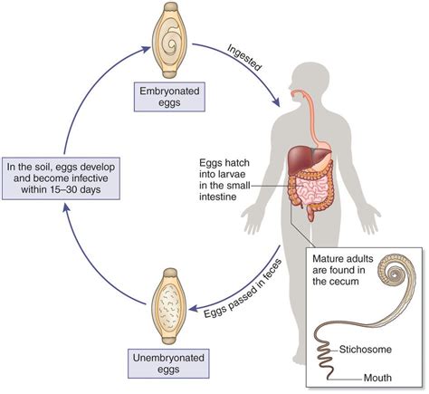 Life Cycle Of Trichuris Trichiura | Images and Photos finder