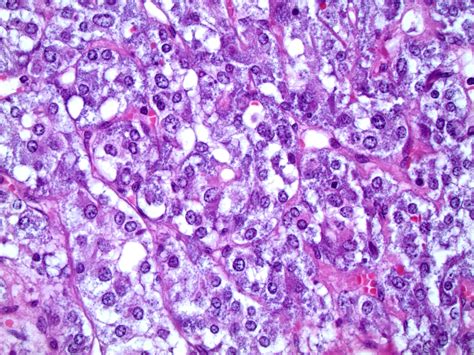 Pathology Outlines - Histology - Adrenal medulla