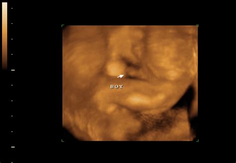 How will your baby look in a 3D ultrasound?