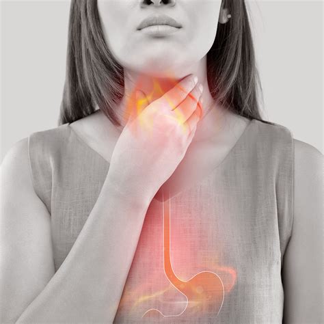 GASTROESOPHAGEAL REFLUX DISEASE (GERD) - Symptoms, Causes, Natural Home ...