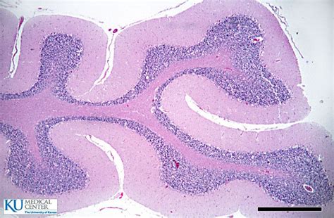 Get Cerebellum Anatomy Histology Gif | Golet Librs