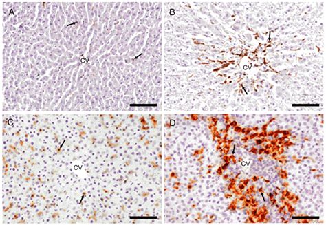 Immunohistochemistry for CD68 (M1-macrophages) and CD163... | Download Scientific Diagram