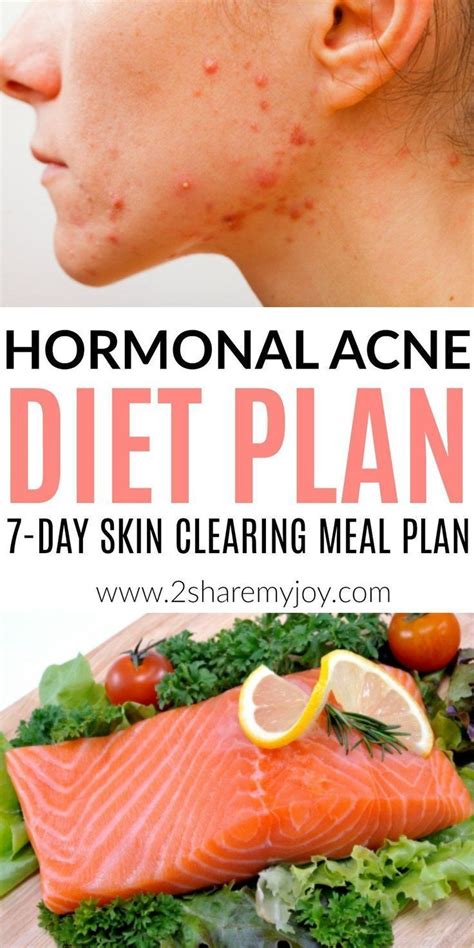 Hormonal Acne Diet Plan (best 7-day clear skin meal plan) | Clear skin diet, Food for acne, Best ...