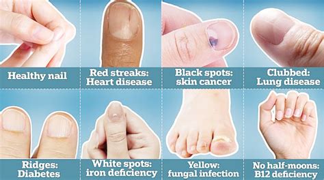 What your nails say about your health, according to an expert - Daily Trust