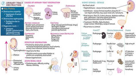 USMLE / COMLEX - Step 2: Urinary Tract Obstruction (focus on Kidney ...