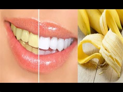 How to get white teeth with banana peels easy and 1 minute teeth ...