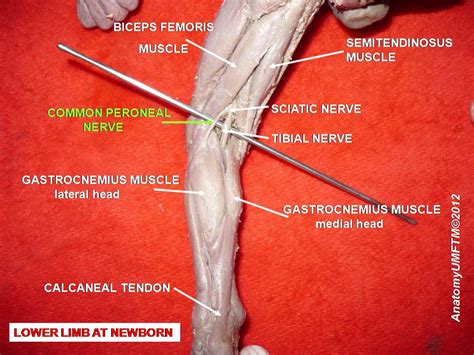 Peroneal Nerve Anatomy - Anatomical Charts & Posters