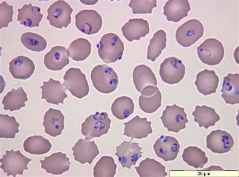 Plasmodium | Hematology, Microbiology lab, Medical laboratory science