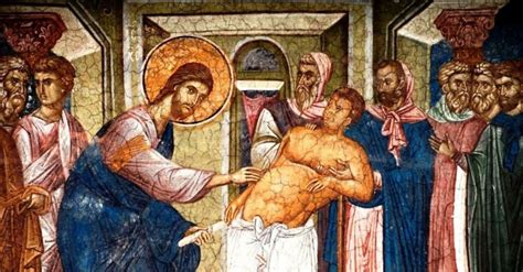 DAILY GOSPEL COMMENTARY. JESUS CURES A MAN WITH DROPSY ON SABBATH (Lk 14:1–6). - Catholics ...