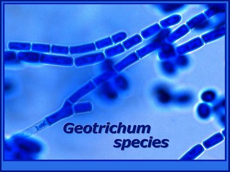 Geotrichum - Alchetron, The Free Social Encyclopedia