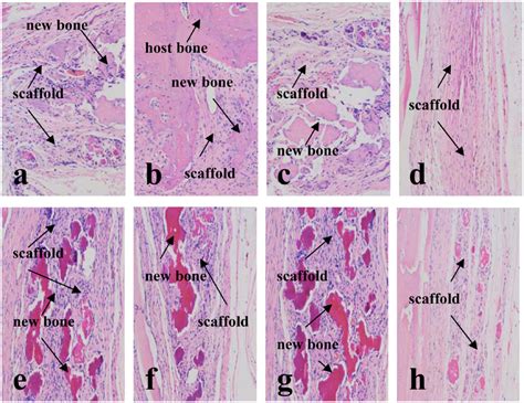 The histological images of the bone defect sites at each time-point:... | Download Scientific ...