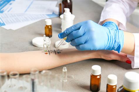 The Importance of Allergy Testing: 4 Benefits You Should Know ...