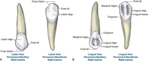 Maxillary Canine Tooth In The Buccal Palatal And Lateral Views | My XXX Hot Girl