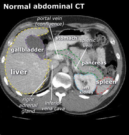 Startradiology | Radiology student, Radiology, Radiology imaging