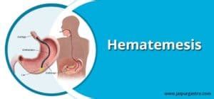 Hematemesis Treatment in Jaipur: Dr. Shankar Dhaka | Jaipur Gastro