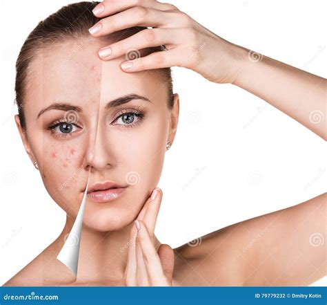 Woman Face before and after Retouch Stock Photo - Image of model, health: 79779232