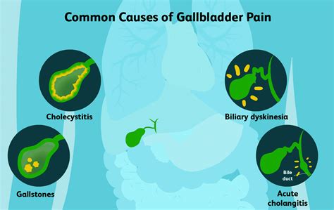 Gallbladder Removal Surgery: Symptoms, Treatment, And Benefits