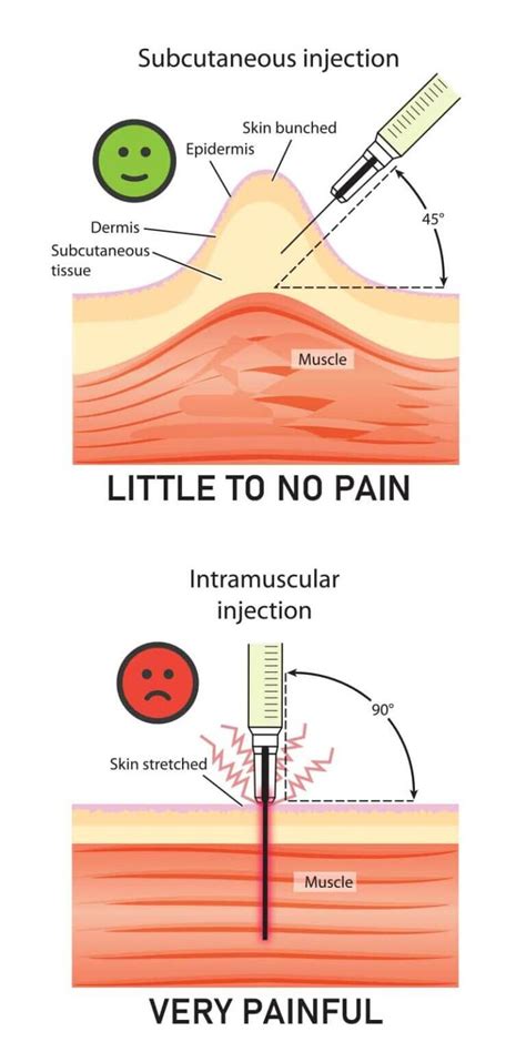 Daily Testosterone Injections vs Weekly | Male Excel