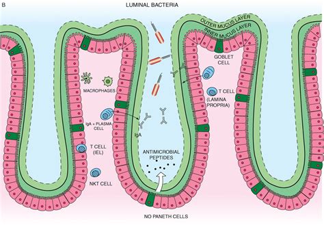 Recent advances in inflammatory bowel disease: mucosal immune cells in ...