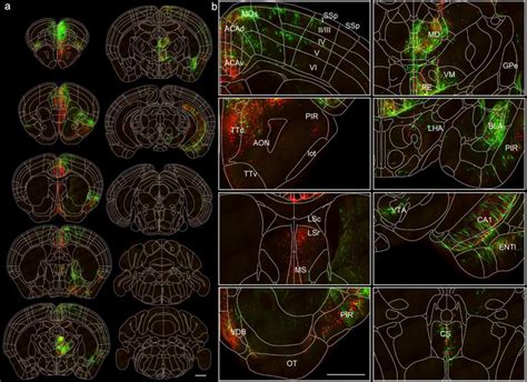 Direct comparison of the long range inputs to SST positive neurons in ...