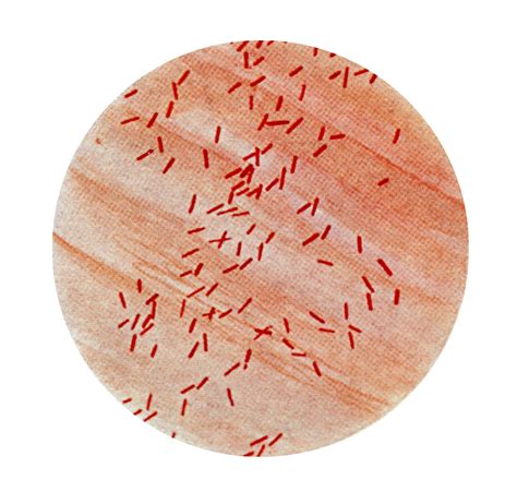 Free picture: photomicrograph, escherichia coli, bacillus, coli ...