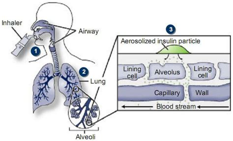 Inhalation of Insulin (Maheux). | Download Scientific Diagram