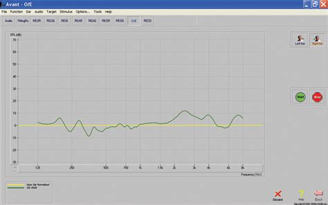 AVANT Software- Computer Based Audiometry Software | MEDRX