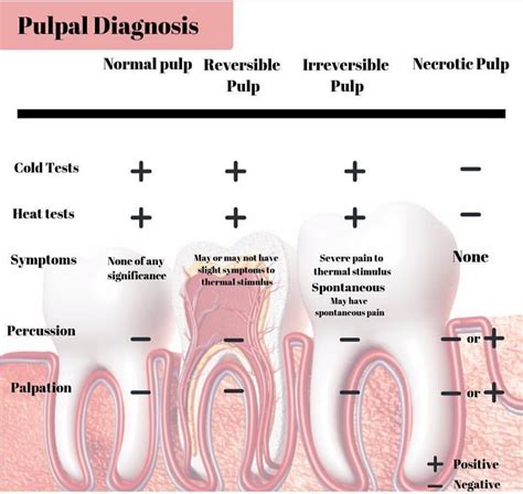 Pulpal diagnosis | Dental hygiene student, Dental exam, Dental videos