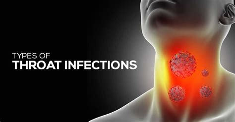 Throat Infections- Overview Of Causes,Types And Remedies! | Marham