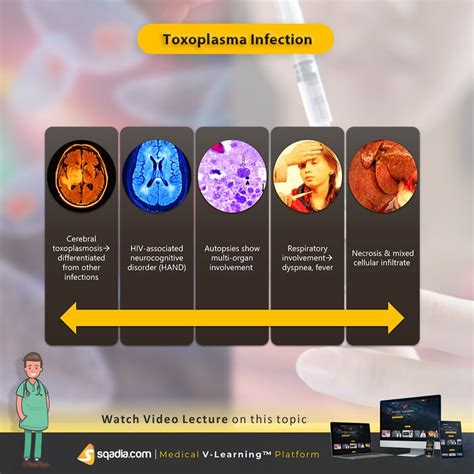 Toxoplasma infections or toxoplasmosis is caused by the infection with an obligate intracellular ...