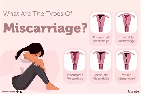 Miscarriage: Signs, Symptoms, Treatment And Prevention