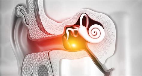 Middle-Ear Barotrauma (MEBT) | DAN Southern Africa