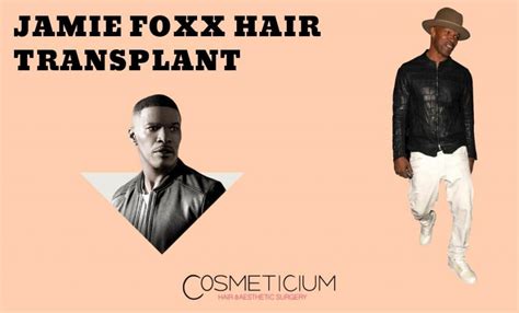 Jamie Foxx Hair Transplantation | Look at His Before & After Photos