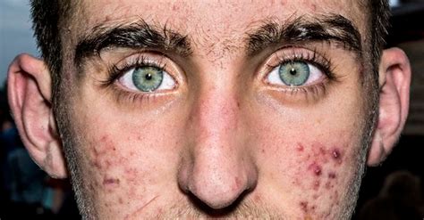 Painfully Close Photos Of Human Faces Look Strangely Inhuman | HuffPost