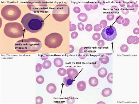 What Is Nrbc On Blood Test at Vito Dianne blog