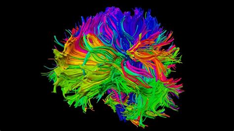 Tractography-brain 3D models - Sketchfab