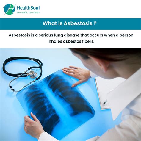 Asbestosis: Symptoms, Diagnosis and Treatment – Healthsoul