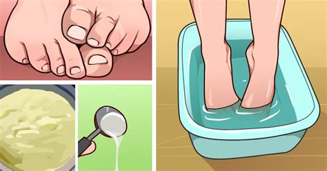 7+ all-natural remedies to help eliminate foot odor