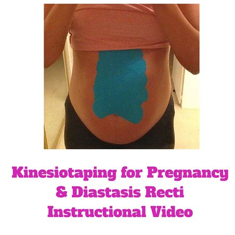 Diastasis Recti Kinesiotaping – Fit Mama Santa Barbara