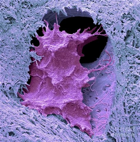 Osteocyte Bone Cell #1 Photograph by Steve Gschmeissner/science Photo ...