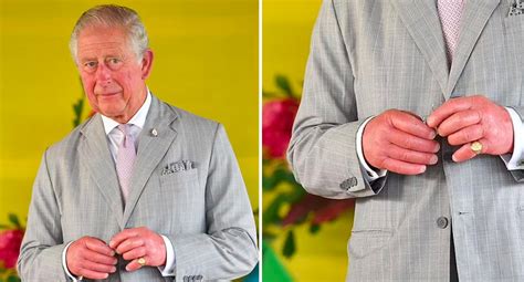 King Charles' 'sausage fingers' spark health concerns