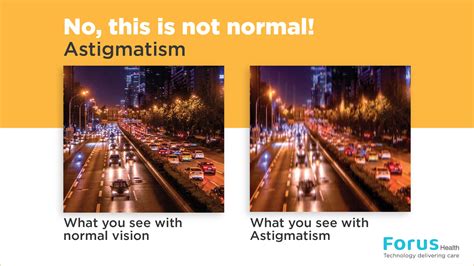 Astigmatism Vision