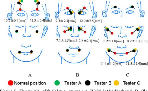 Figure 5 from Development of a face robot for cranial nerves examination training | Semantic Scholar