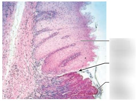 Quiz 6: histology of gastroesophageal junction Diagram | Quizlet