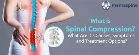 Spinal Compression Causes, Symptoms, and Treatment Options?