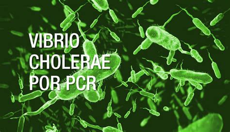 VIBRIO CHOLERAE POR PCR - Referencia Laboratorio Clínico