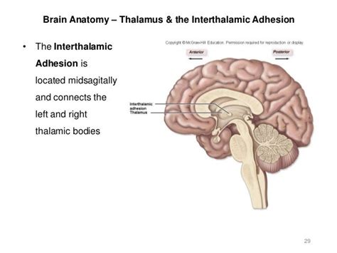 Activity 7 - Brain & Cranial Nerves