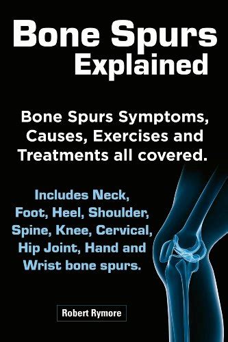 Bone Spurs explained. Bone Spurs Symptoms, Causes, Exercises and ...