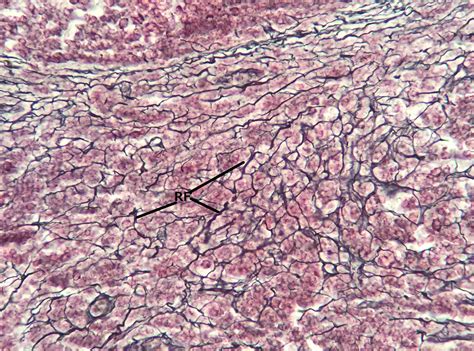 Reticular Connective Tissue 20x | Histology